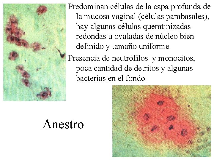 Predominan células de la capa profunda de la mucosa vaginal (células parabasales), hay algunas