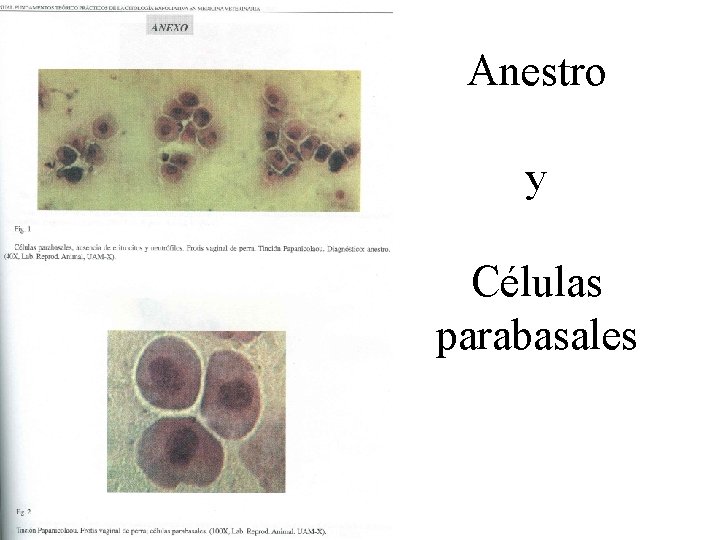 Anestro y Células parabasales 