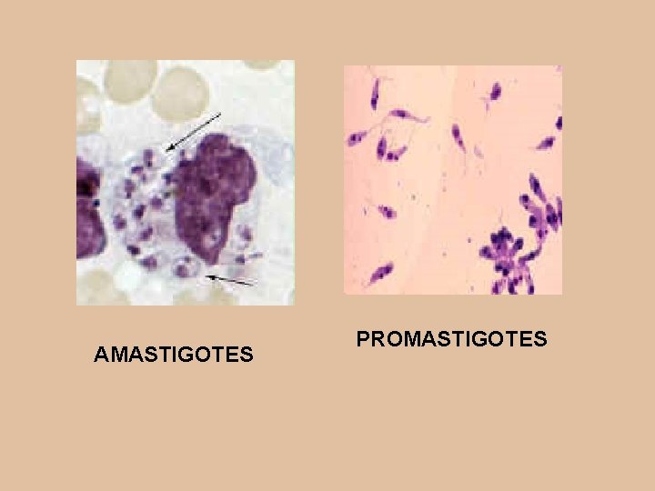 AMASTIGOTES PROMASTIGOTES 