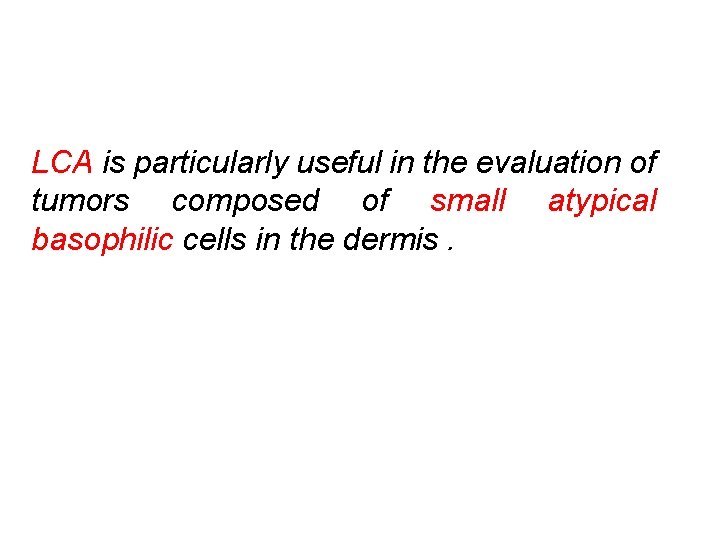 LCA is particularly useful in the evaluation of tumors composed of small atypical basophilic