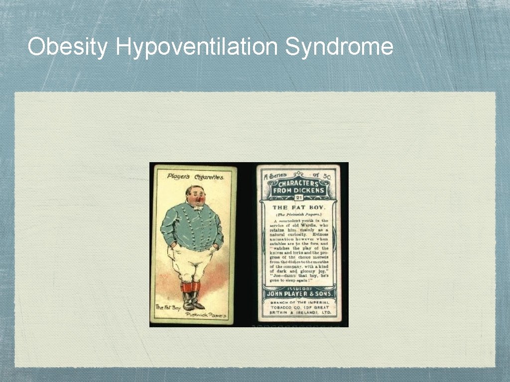 Obesity Hypoventilation Syndrome 