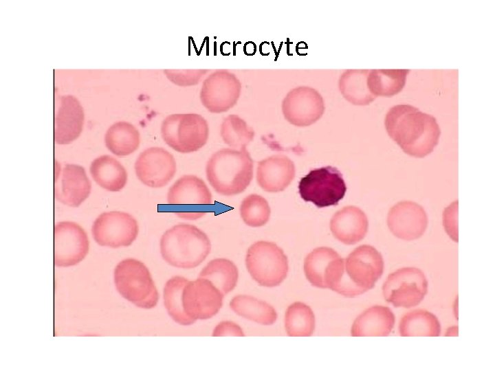 Microcyte 