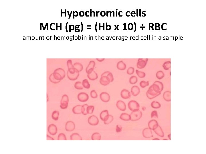 Hypochromic cells MCH (pg) = (Hb x 10) ÷ RBC amount of hemoglobin in