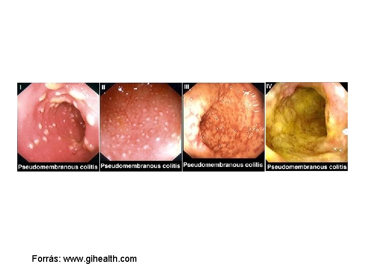 Forrás: www. gihealth. com 