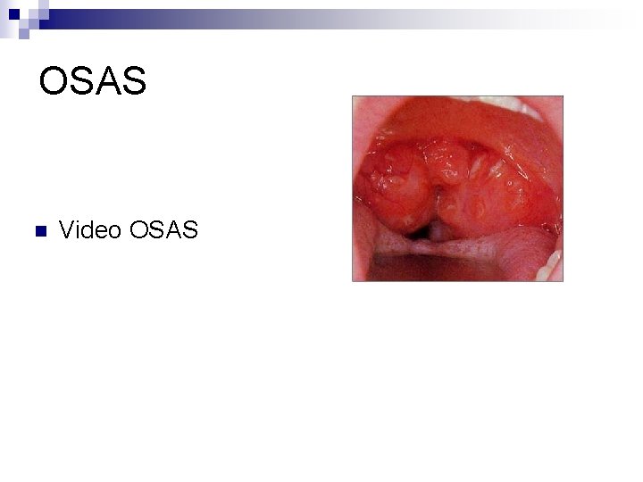 OSAS n Video OSAS 