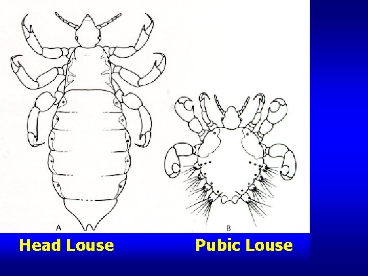 Head Louse Pubic Louse 