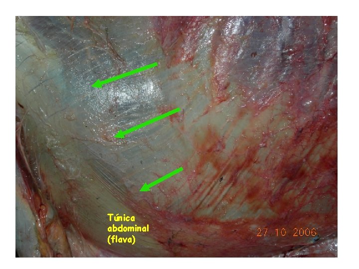 Túnica abdominal (flava) 