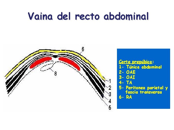 Vaina del recto abdominal Corte prepúbico: 1 - Túnica abdominal 2 - OAE 3
