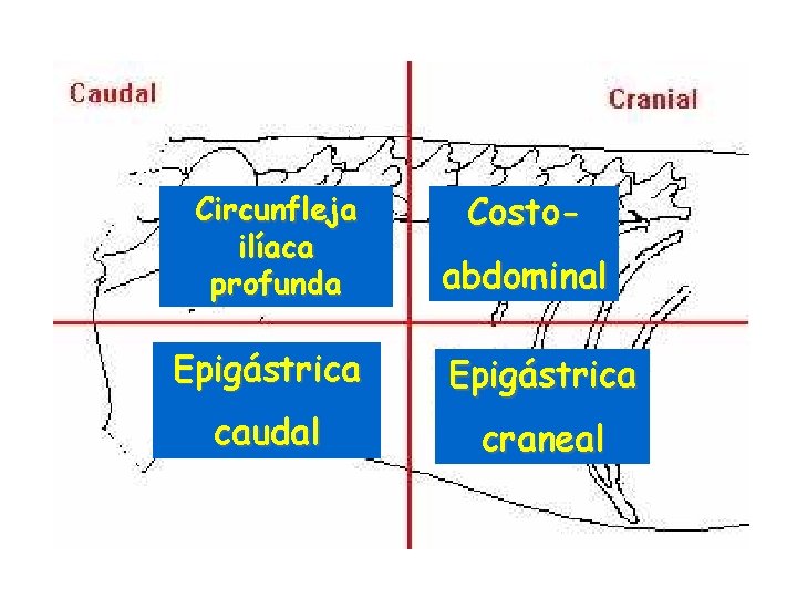 Circunfleja ilíaca profunda Costoabdominal Epigástrica caudal craneal 