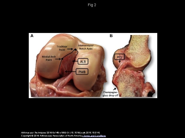 Fig 2 Arthroscopy Techniques 2016 5 e 149 -e 156 DOI: (10. 1016/j. eats.