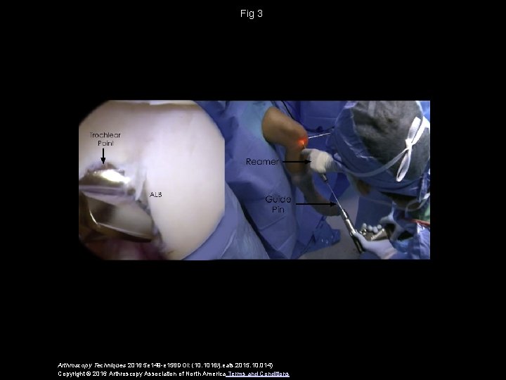 Fig 3 Arthroscopy Techniques 2016 5 e 149 -e 156 DOI: (10. 1016/j. eats.