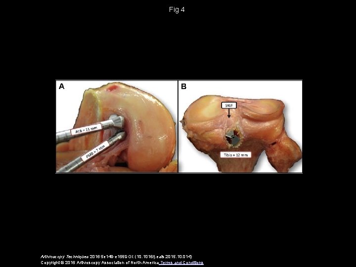 Fig 4 Arthroscopy Techniques 2016 5 e 149 -e 156 DOI: (10. 1016/j. eats.