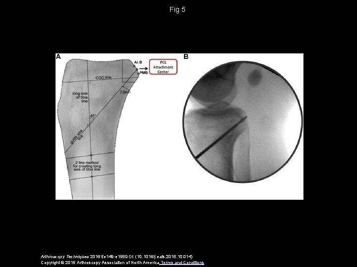 Fig 5 Arthroscopy Techniques 2016 5 e 149 -e 156 DOI: (10. 1016/j. eats.