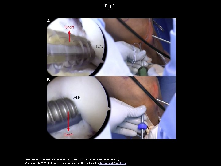 Fig 6 Arthroscopy Techniques 2016 5 e 149 -e 156 DOI: (10. 1016/j. eats.