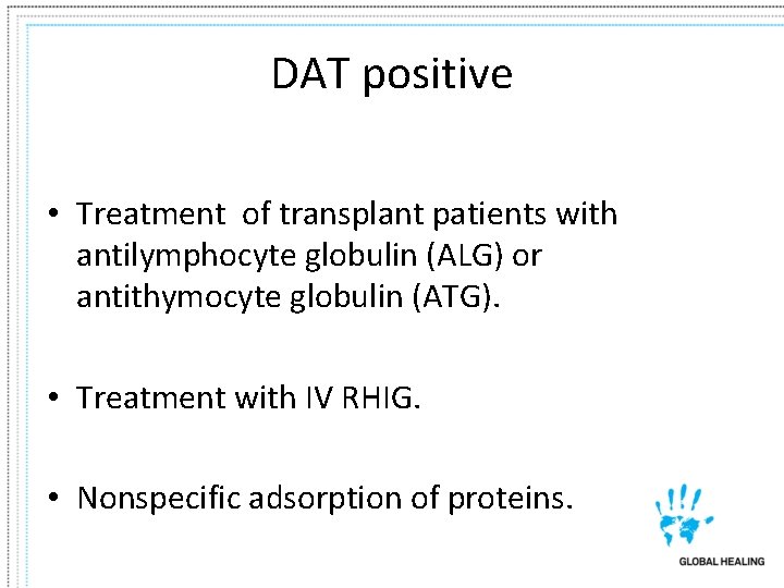 DAT positive • Treatment of transplant patients with antilymphocyte globulin (ALG) or antithymocyte globulin