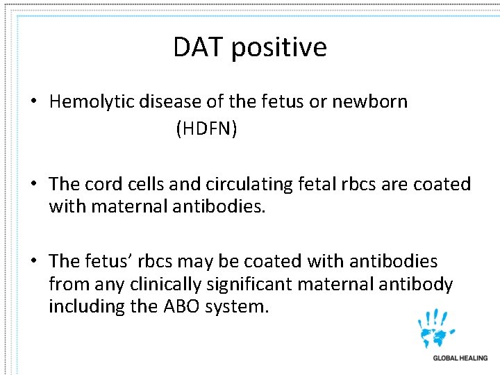 DAT positive • Hemolytic disease of the fetus or newborn (HDFN) • The cord