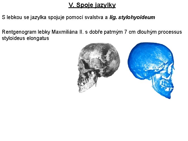 V. Spoje jazylky S lebkou se jazylka spojuje pomocí svalstva a lig. stylohyoideum Rentgenogram