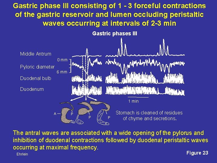 Gastric phase III consisting of 1 - 3 forceful contractions of the gastric reservoir