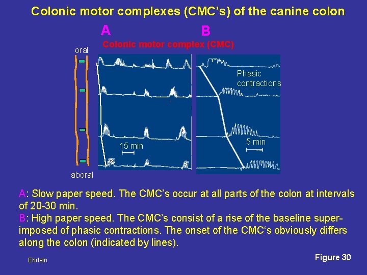 Colonic motor complexes (CMC’s) of the canine colon A oral B Colonic motor complex