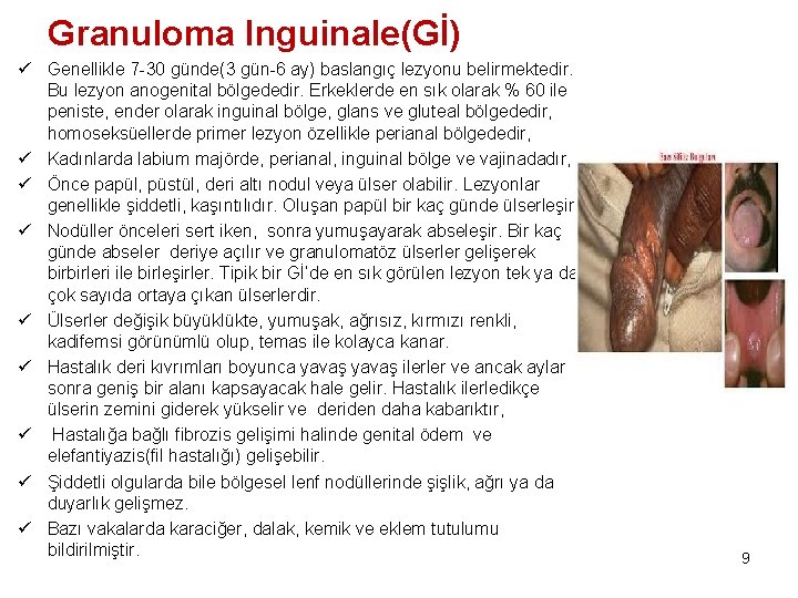 Granuloma Inguinale(Gİ) ü Genellikle 7 -30 günde(3 gün-6 ay) baslangıç lezyonu belirmektedir. Bu lezyon