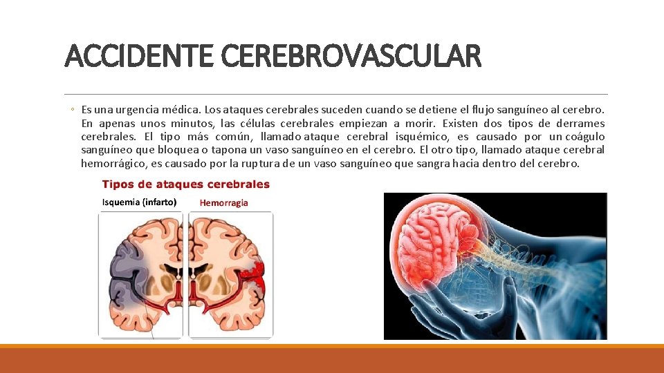 ACCIDENTE CEREBROVASCULAR ◦ Es una urgencia médica. Los ataques cerebrales suceden cuando se detiene