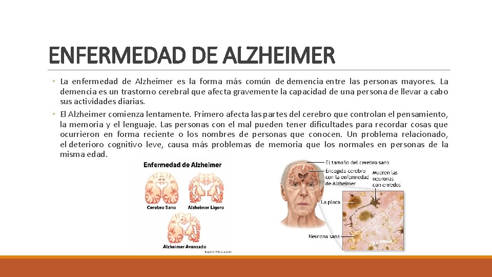 ENFERMEDAD DE ALZHEIMER ◦ La enfermedad de Alzheimer es la forma más común de