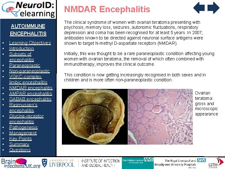 NMDAR Encephalitis AUTOIMMUNE ENCEPHALITIS • • • • Learning Objectives Introduction Subsets of encephalitis