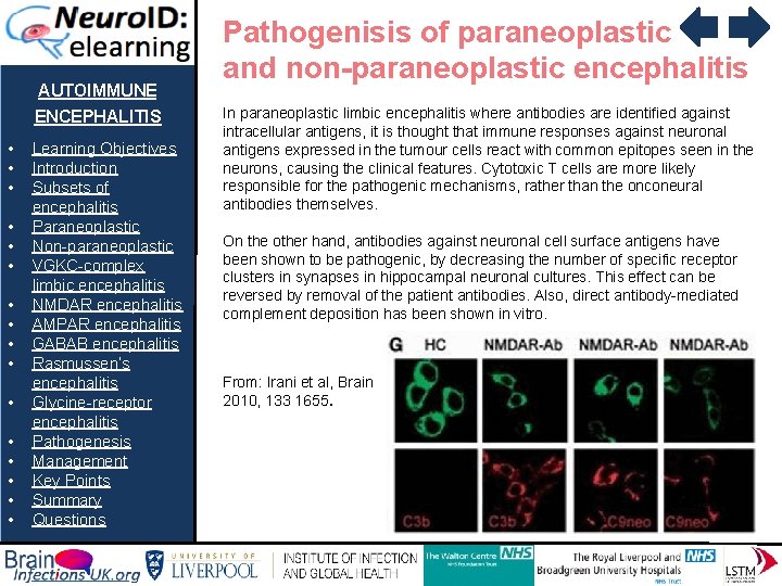 AUTOIMMUNE ENCEPHALITIS • • • • Learning Objectives Introduction Subsets of encephalitis Paraneoplastic Non-paraneoplastic