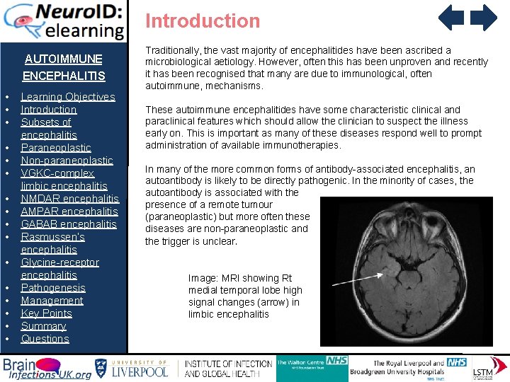 Introduction AUTOIMMUNE ENCEPHALITIS • • • • Learning Objectives Introduction Subsets of encephalitis Paraneoplastic