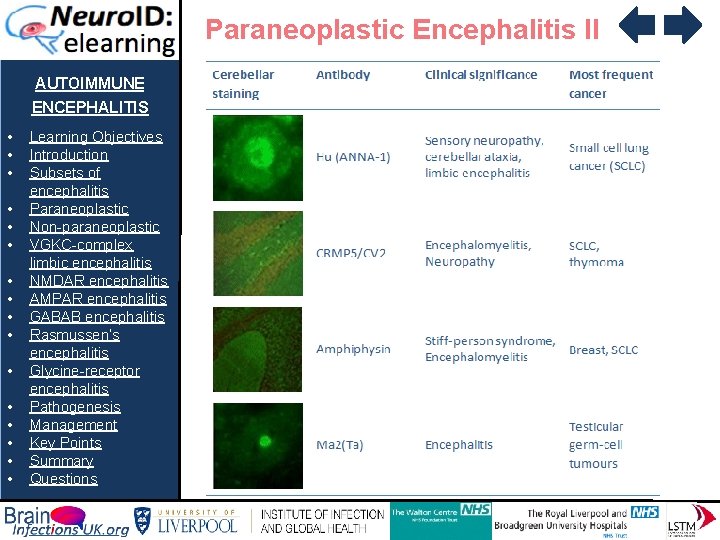 Paraneoplastic Encephalitis II AUTOIMMUNE ENCEPHALITIS • • • • Learning Objectives Introduction Subsets of