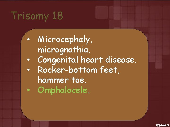 Trisomy 18 • Microcephaly, micrognathia. • Congenital heart disease. • Rocker-bottom feet, hammer toe.