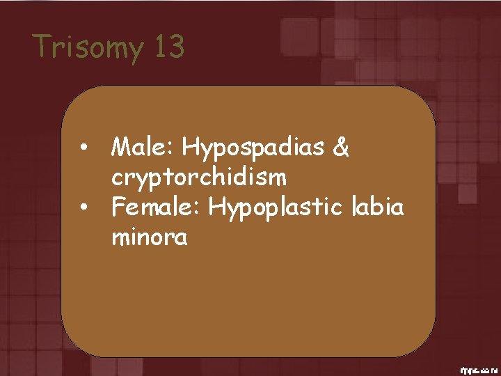 Trisomy 13 • Male: Hypospadias & cryptorchidism • Female: Hypoplastic labia minora 