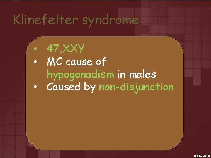 Klinefelter syndrome • 47, XXY • MC cause of hypogonadism in males • Caused