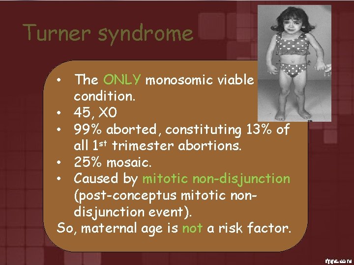 Turner syndrome • The ONLY monosomic viable condition. • 45, X 0 • 99%