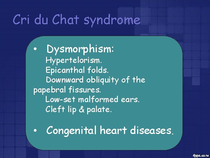 Cri du Chat syndrome • Dysmorphism: Hypertelorism. Epicanthal folds. Downward obliquity of the papebral