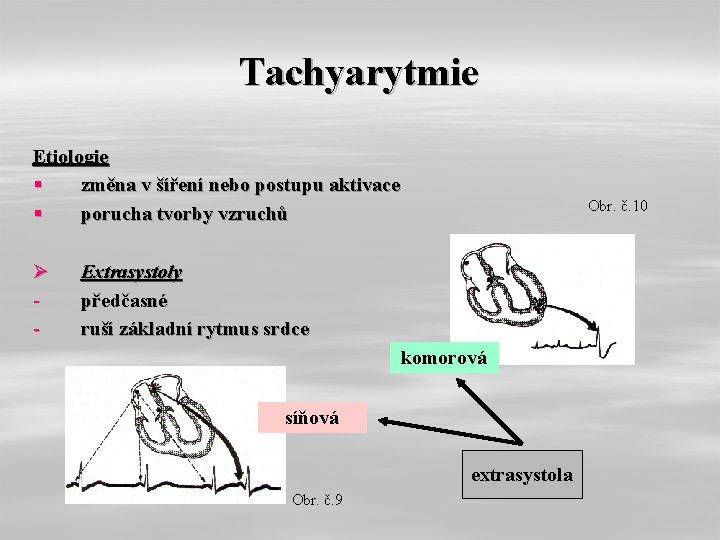 Tachyarytmie Etiologie § změna v šíření nebo postupu aktivace § porucha tvorby vzruchů Ø