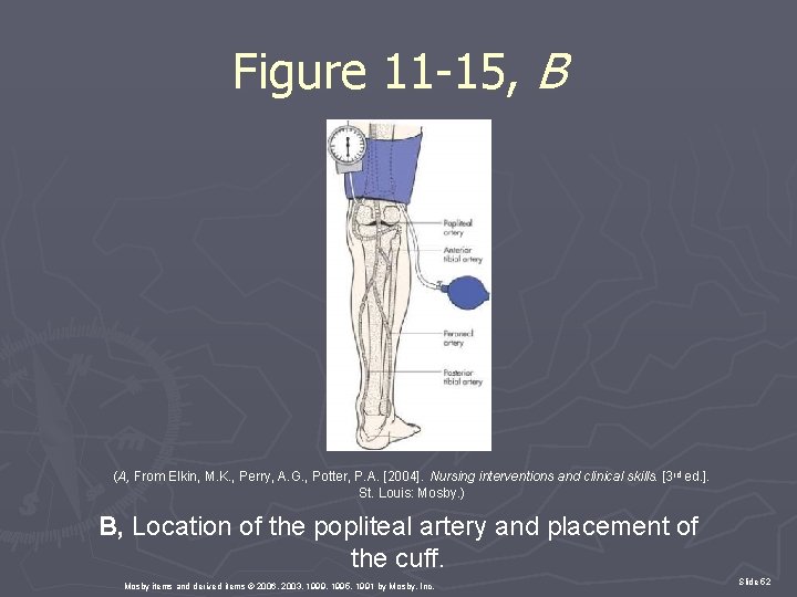 Figure 11 -15, B (A, From Elkin, M. K. , Perry, A. G. ,