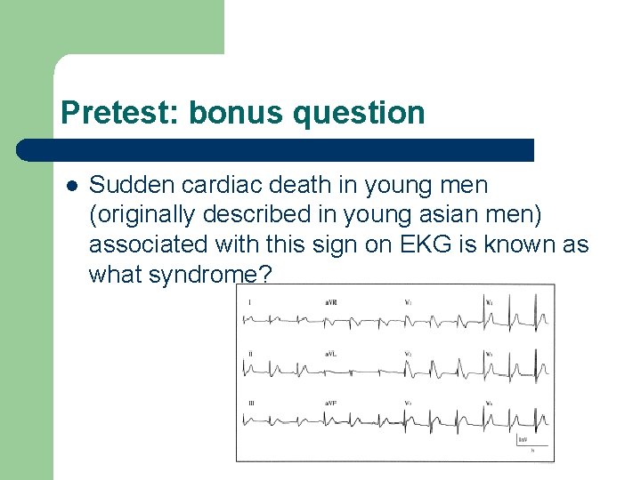 Pretest: bonus question l Sudden cardiac death in young men (originally described in young
