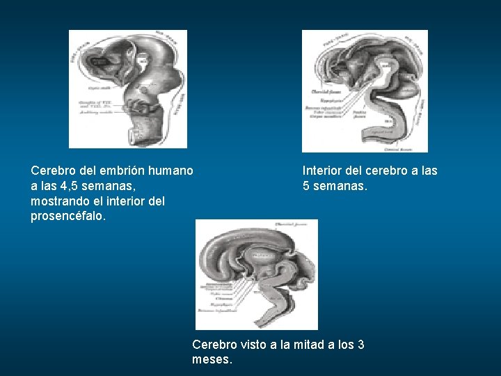 Cerebro del embrión humano a las 4, 5 semanas, mostrando el interior del prosencéfalo.