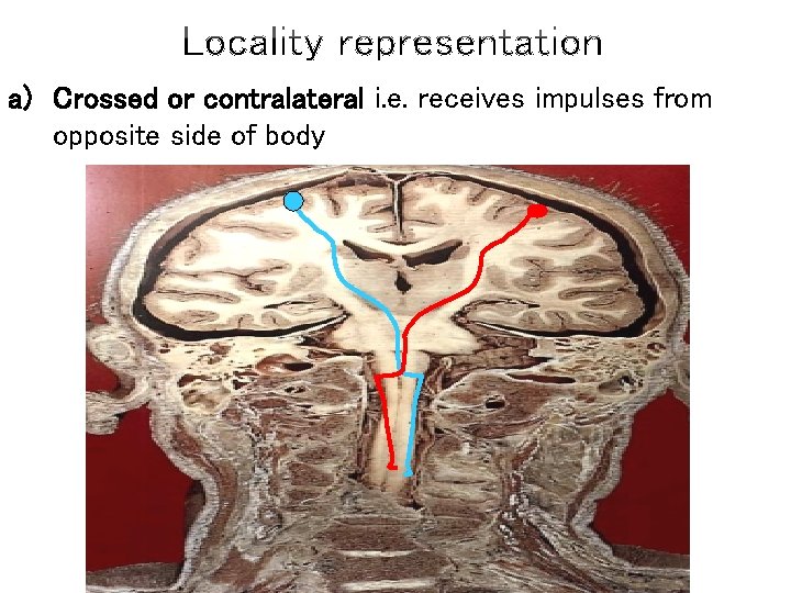 a) Crossed or contralateral i. e. receives impulses from opposite side of body 