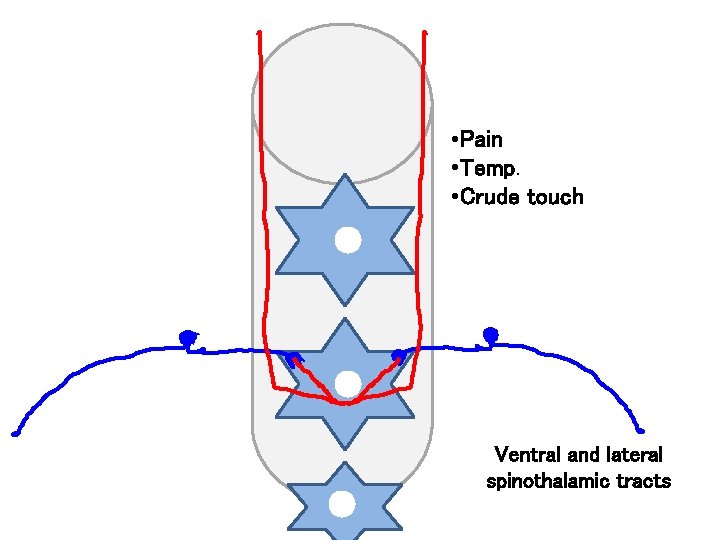  • Pain • Temp. • Crude touch Ventral and lateral spinothalamic tracts 