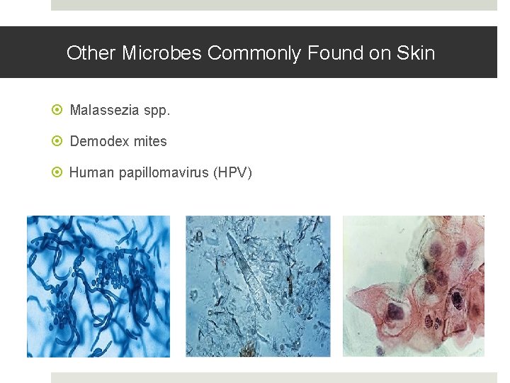 Other Microbes Commonly Found on Skin Malassezia spp. Demodex mites Human papillomavirus (HPV) 