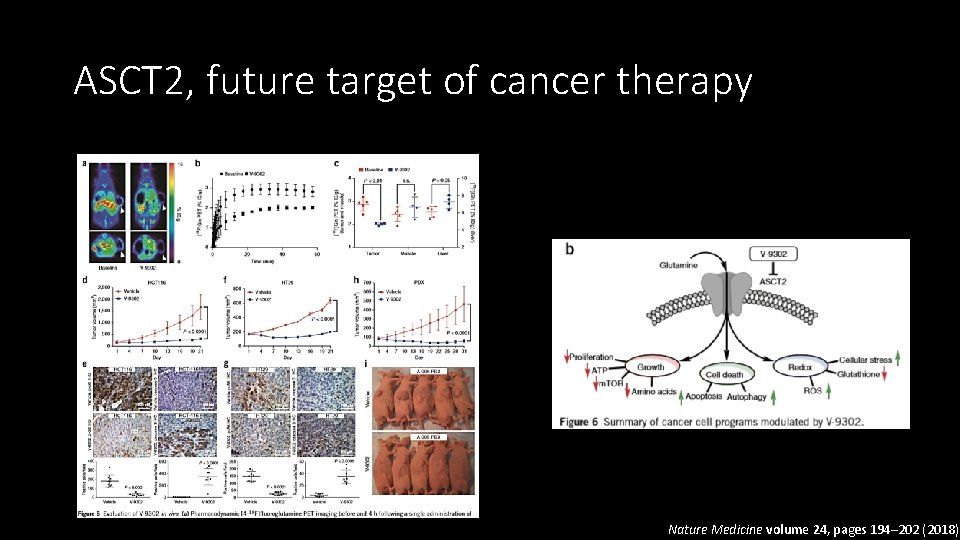 ASCT 2, future target of cancer therapy Nature Medicine volume 24, pages 194– 202