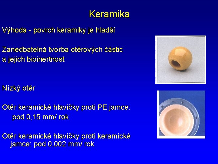 Keramika Výhoda - povrch keramiky je hladší Zanedbatelná tvorba otěrových částic a jejich bioinertnost