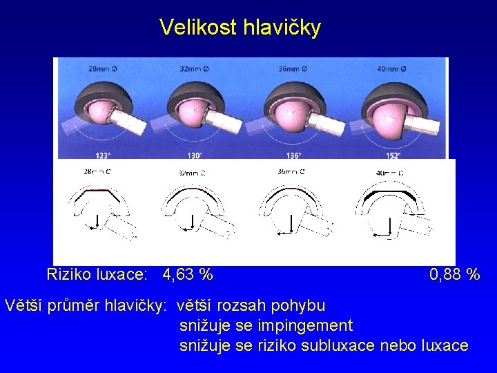 Velikost hlavičky Riziko luxace: 4, 63 % 0, 88 % Větší průměr hlavičky: větší