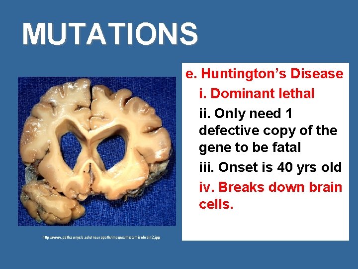 MUTATIONS e. Huntington’s Disease i. Dominant lethal ii. Only need 1 defective copy of