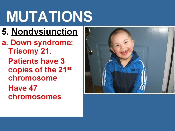 MUTATIONS 5. Nondysjunction a. Down syndrome: Trisomy 21. Patients have 3 copies of the