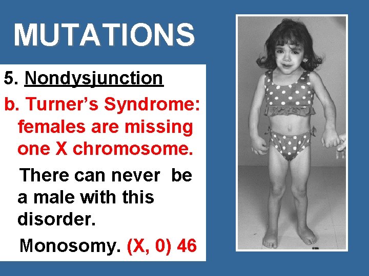 MUTATIONS 5. Nondysjunction b. Turner’s Syndrome: females are missing one X chromosome. There can