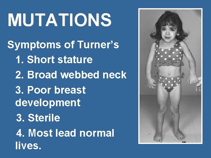 MUTATIONS Symptoms of Turner’s 1. Short stature 2. Broad webbed neck 3. Poor breast