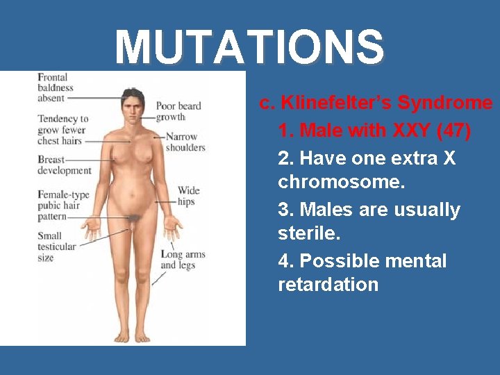 MUTATIONS c. Klinefelter’s Syndrome 1. Male with XXY (47) 2. Have one extra X